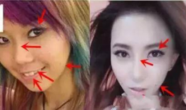 网红整容事件,美丽背后的代价与反思
